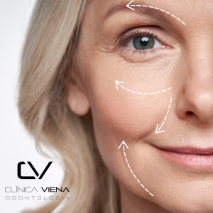 Toxina Botulínica (Meditoxin) 3 zonas