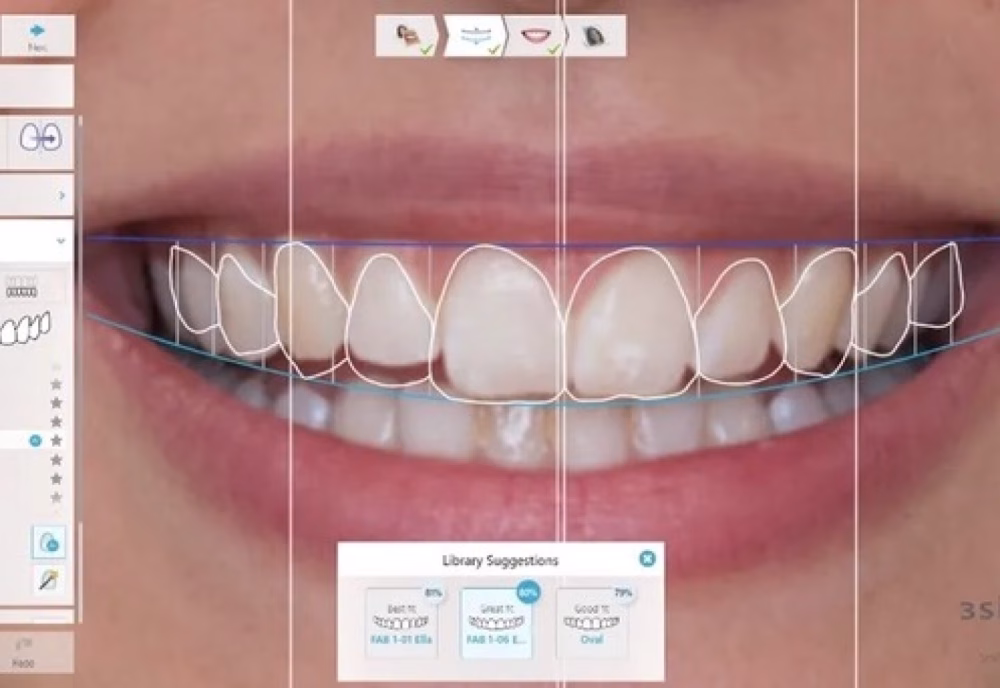 Pantalla de software con diseño de sonrisa digital.