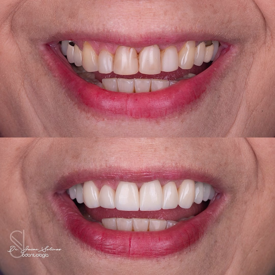 582089805_18545110714016596_7091928050388390206_n